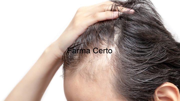 Queda de Cabelo