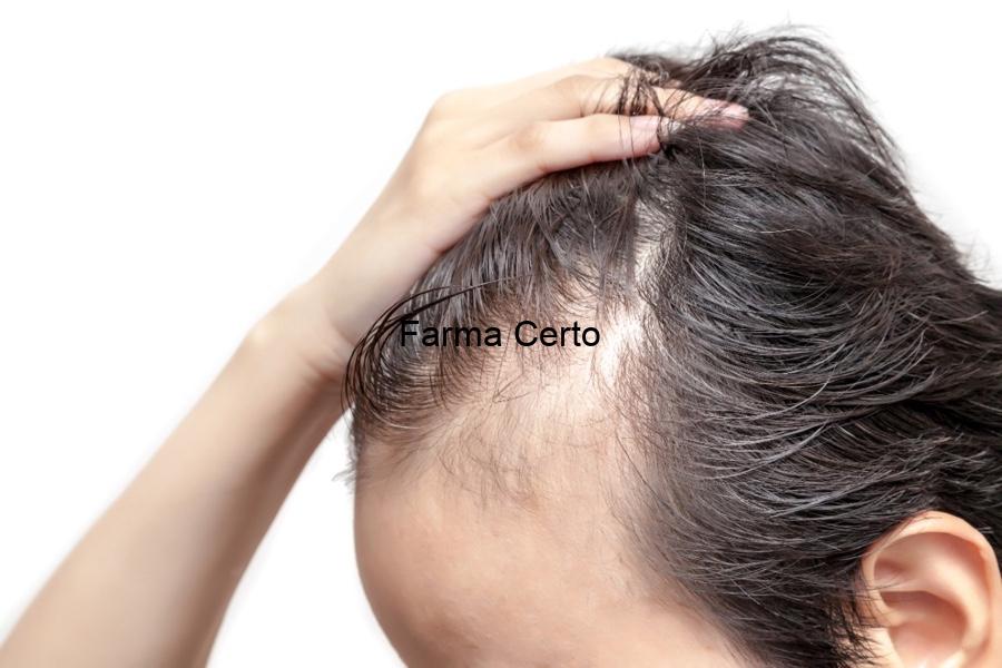 Queda de Cabelo