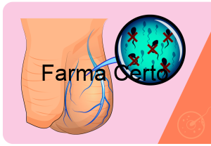 Atrofia Testicular