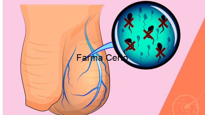 Atrofia Testicular